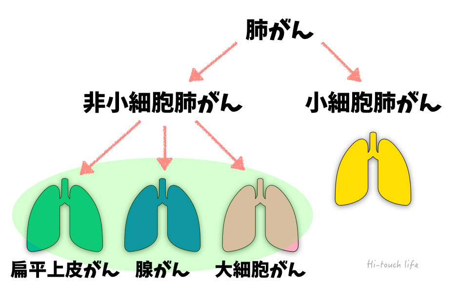 速報 Bmy 小野薬品保有者喚起 オプジーボが中国で肺がんの承認を取得 Fireムーブメントを日本で実践するブログ